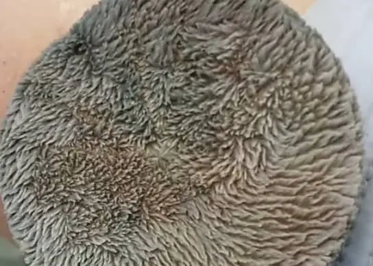sand dollar spines called cilia