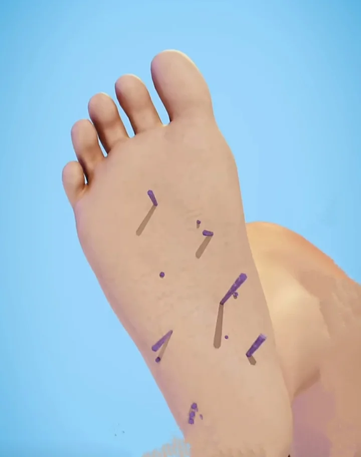 What Happens If I Get Pricked by a Sea Urchin